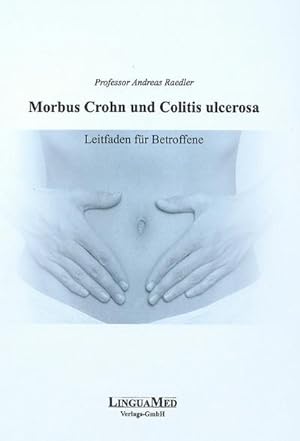 Bild des Verkufers fr Morbus Crohn und Colitis ulcerosa: Leitfaden fr Betroffene zum Verkauf von buchversandmimpf2000