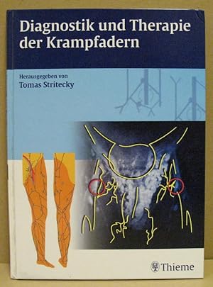 Bild des Verkufers fr Diagnostik und Therapie der Krampfadern. zum Verkauf von Nicoline Thieme