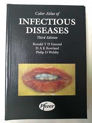 Immagine del venditore per Infectious diseases venduto da Libros Ambig