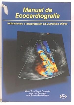 Immagine del venditore per Manual De Ecocardiografa, Indicacinoes E Interpretaciones En La Prctica venduto da SalvaLibros