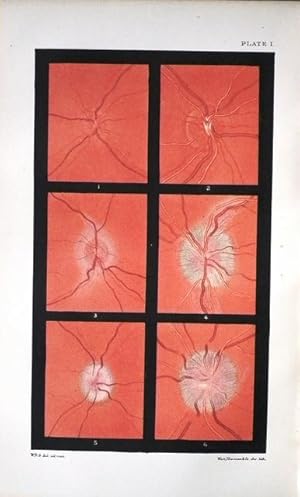 Bild des Verkufers fr A Manual and Atlas of Medical Ophthalmoscopy. zum Verkauf von Patrick Pollak Rare Books ABA ILAB