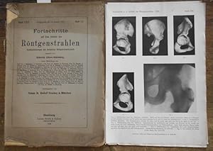 Image du vendeur pour Rntgenstrahlen, Fortschritte auf dem Gebiete der. Band XXX, Heft 1/2 , 15. Januar 1923. Publikationsorgan der Deutschen Rntgen-Gesellschaft, begr. Von Heinrich Albers-Schnberg. mis en vente par Antiquariat Carl Wegner