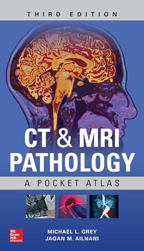 Seller image for Ct & MRI Pathology : A Pocket Atlas for sale by GreatBookPrices