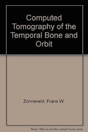 Computed Tomography of the Temporal Bone and Orbit