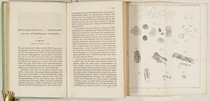 Bild des Verkufers fr Rhrengeschwulst , - Siphonoma, eine neue Art pathologischer Geschwlste (pp.130-146, Taf. II. Fig. 4-10). zum Verkauf von Antiq. F.-D. Shn - Medicusbooks.Com