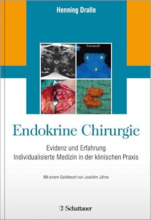 Endokrine Chirurgie Evidenz und Erfahrung - Individualisierte Medizin in der klinischen Praxis