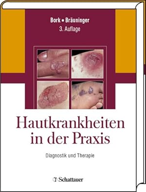 Immagine del venditore per Hautkrankheiten in der Praxis. Diagnostik und Therapie venduto da primatexxt Buchversand