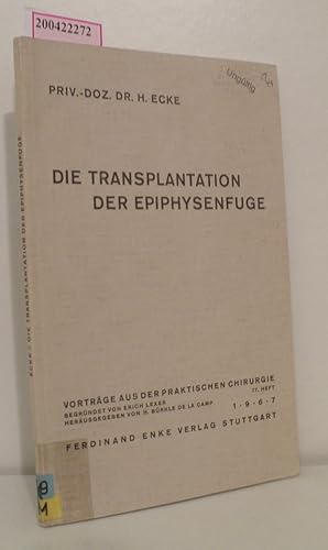 Imagen del vendedor de Die Transplantation der Epiphysenfuge Hermann Ecke a la venta por ralfs-buecherkiste