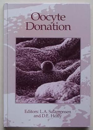 Oocyte donation.