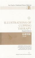 Bild des Verkufers fr ILLUSTRATIONS OF TONGUE DIAGNOSIS(IN ENGLISH)(Chinese Edition) zum Verkauf von liu xing