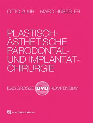 Bild des Verkufers fr Plastisch-sthetische Parodontal- und Implantatchirurgie : Das groe DVD Kompendium in Box zum Verkauf von AHA-BUCH GmbH