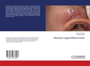 Immagine del venditore per Human Lagochilascariasis venduto da BuchWeltWeit Ludwig Meier e.K.