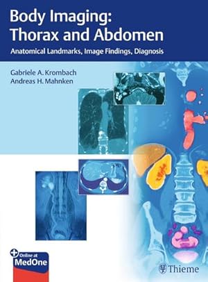 Seller image for Body Imaging: Thorax and Abdomen : Anatomical Landmarks, Image Findings, Diagnosis. Plus Online at MedOne for sale by AHA-BUCH GmbH