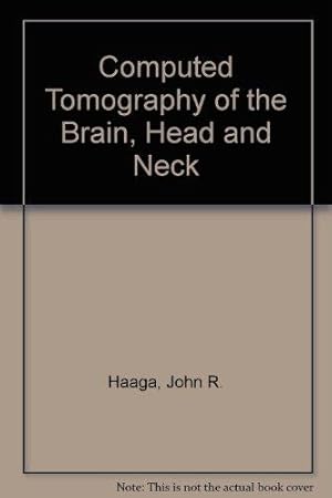 Computed Tomography of the Brain, Head and Neck