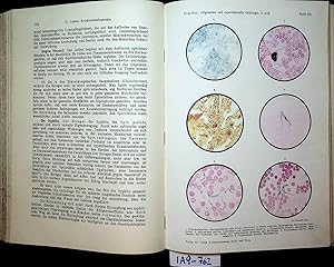 Allgemeine und experimentelle Pathologie : nach Vorlesungen für Studierende und Ärzte. 2. verm. u...