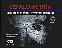 Seller image for CEFALOMETRIA. TECNICAS DE DIAGNOSTICO Y PROCEDIMIENTOS + CD-ROM for sale by Vuestros Libros