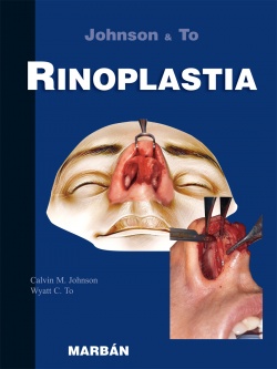 Seller image for Rinoplastia for sale by Vuestros Libros