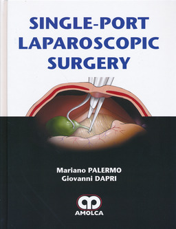 Seller image for SINGLE-PORT LAPAROSCOPIC SURGERY for sale by Vuestros Libros