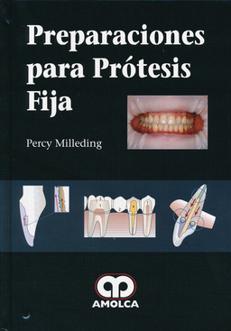 Seller image for PREPARACIONES PARA PROTESIS FIJA for sale by Vuestros Libros