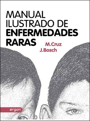 Seller image for MANUAL ILUSTRADO DE ENFERMEDADES RARAS for sale by Vuestros Libros