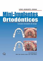 Seller image for Mini-Implantes Ortodnticos for sale by Vuestros Libros