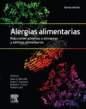 Bild des Verkufers fr Alergias alimentarias zum Verkauf von Vuestros Libros