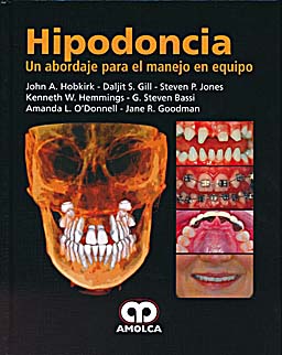 Seller image for HIPODONCIA for sale by Vuestros Libros