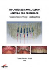 Imagen del vendedor de Implantologa Oral Guiada Asistida por Ordenador a la venta por Vuestros Libros