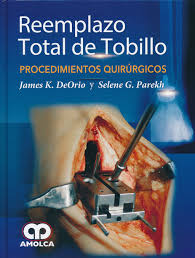 Seller image for REEMPLAZO TOTAL DE TOBILLO PROCEDIMIENTOS QUIRURGICOS for sale by Vuestros Libros