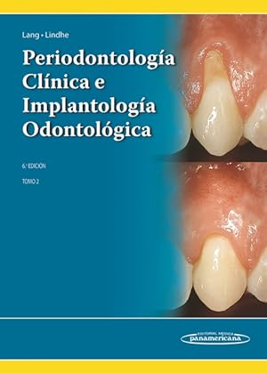 Seller image for Periodontologa Clnica e Implantologa Odontolgica. Tomo 2 for sale by Vuestros Libros