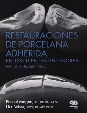 Immagine del venditore per Restauraciones de Porcelana Adherida en los Dientes Anteriores: Un Enfoque Biomimtico venduto da Vuestros Libros
