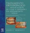 Tratamiento ortodóncico de la maloclusión Clase II División 1 sin apiñamiento en los niños