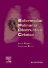 Enfermedad pulmonar obstructiva crónica