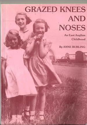 Grazed Knees and Noses: An East Anglian Childhood