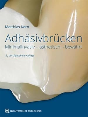 Bild des Verkufers fr Adhsivbrcken : Minimalinvasiv - sthetisch - bewhrt zum Verkauf von AHA-BUCH GmbH