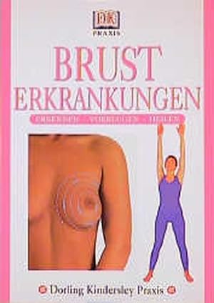 Immagine del venditore per DK Praxis: Brusterkrankungen venduto da Versandantiquariat Felix Mcke