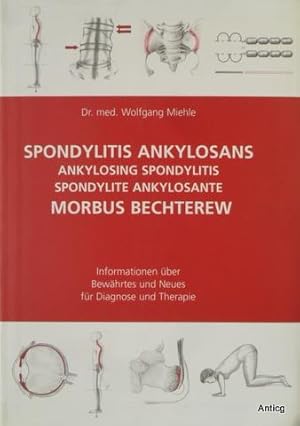 Spondylitis ankylosans - Morbus Bechterew. Informationen über Bewährtes und Neues für Diagnose un...