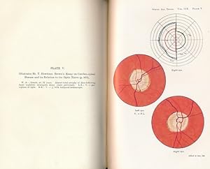 Imagen del vendedor de Transactions of the Ophthalmological Society of the United Kingdom. Volume LIX (59) Part II. Session 1939 a la venta por Barter Books Ltd