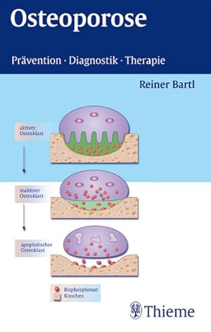 Imagen del vendedor de Osteoporose Prvention - Diagnostik - Therapie a la venta por NEPO UG