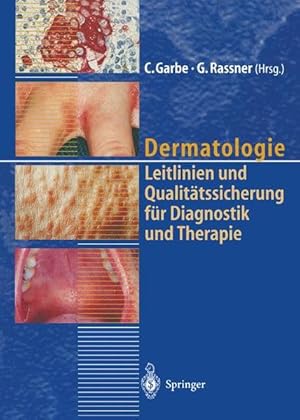 Bild des Verkufers fr Dermatologie: Leitlinien und Qualittssicherung fr Diagnostik und Therapie Berichte von der 39. Tagung der Deutschen Dermatologischen Gesellschaft Leitlinien und Qualittssicherung fr Diagnostik und Therapie Berichte von der 39. Tagung der Deutschen Dermatologischen Gesellschaft zum Verkauf von NEPO UG