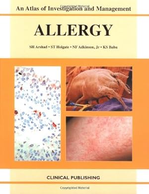 Bild des Verkufers fr Allergy: An Atlas of Investigation and Management: An Atlas of Investigation and Diagnosis zum Verkauf von NEPO UG