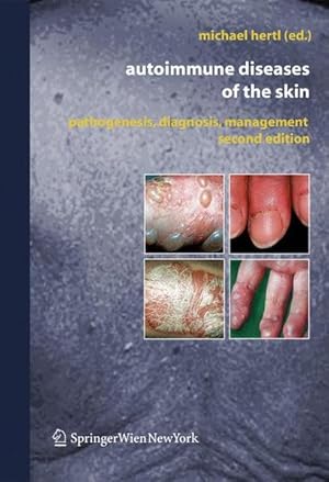 Seller image for Autoimmune Diseases of the Skin: Pathogenesis, Diagnosis, Management Pathogenesis, Diagnosis, Management for sale by NEPO UG