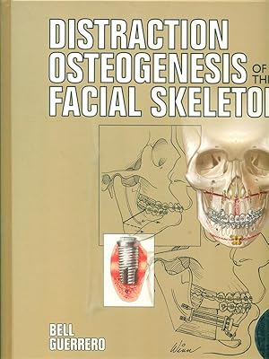 Distraction Osteogenesis of the Facial Skeleton (With CDROM)