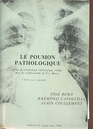 Image du vendeur pour Le poumon pathologique - Atlas de semiologie radiologique - mis en vente par Le-Livre