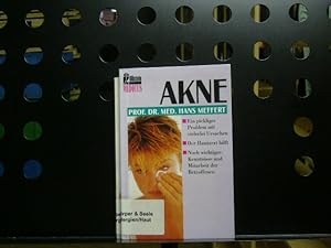 Imagen del vendedor de Akne a la venta por Antiquariat im Kaiserviertel | Wimbauer Buchversand