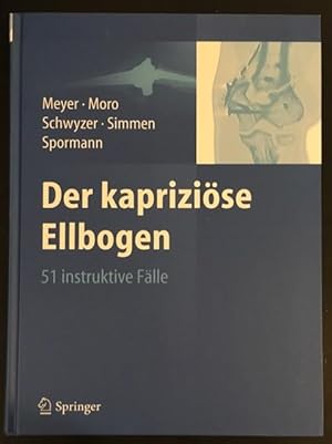 Imagen del vendedor de Der kaprizise Ellbogen - 51 instruktive Flle. a la venta por Antiquariat Im Seefeld / Ernst Jetzer