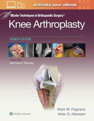 Imagen del vendedor de Master Techniques in Orthopedic Surgery: Knee Arthroplasty (Master Techniques in Orthopaedic Surgery) a la venta por AHA-BUCH GmbH