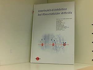 Interleukin-6-Inhibition bei Rheumatoider Arthritis