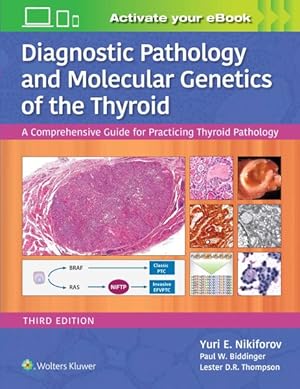 Immagine del venditore per Diagnostic Pathology and Molecular Genetics of the Thyroid : A Comprehensive Guide for Practicing Thyroid Pathology venduto da GreatBookPrices