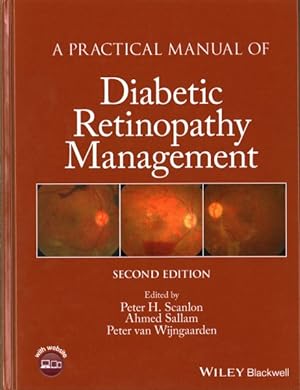 Bild des Verkufers fr Practical Manual of Diabetic Retinopathy Management zum Verkauf von GreatBookPrices